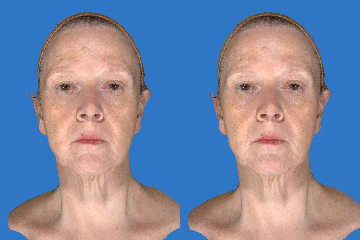 Face Assessment Animation - 360 x 240