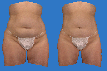 body contouring animation 360 x 240